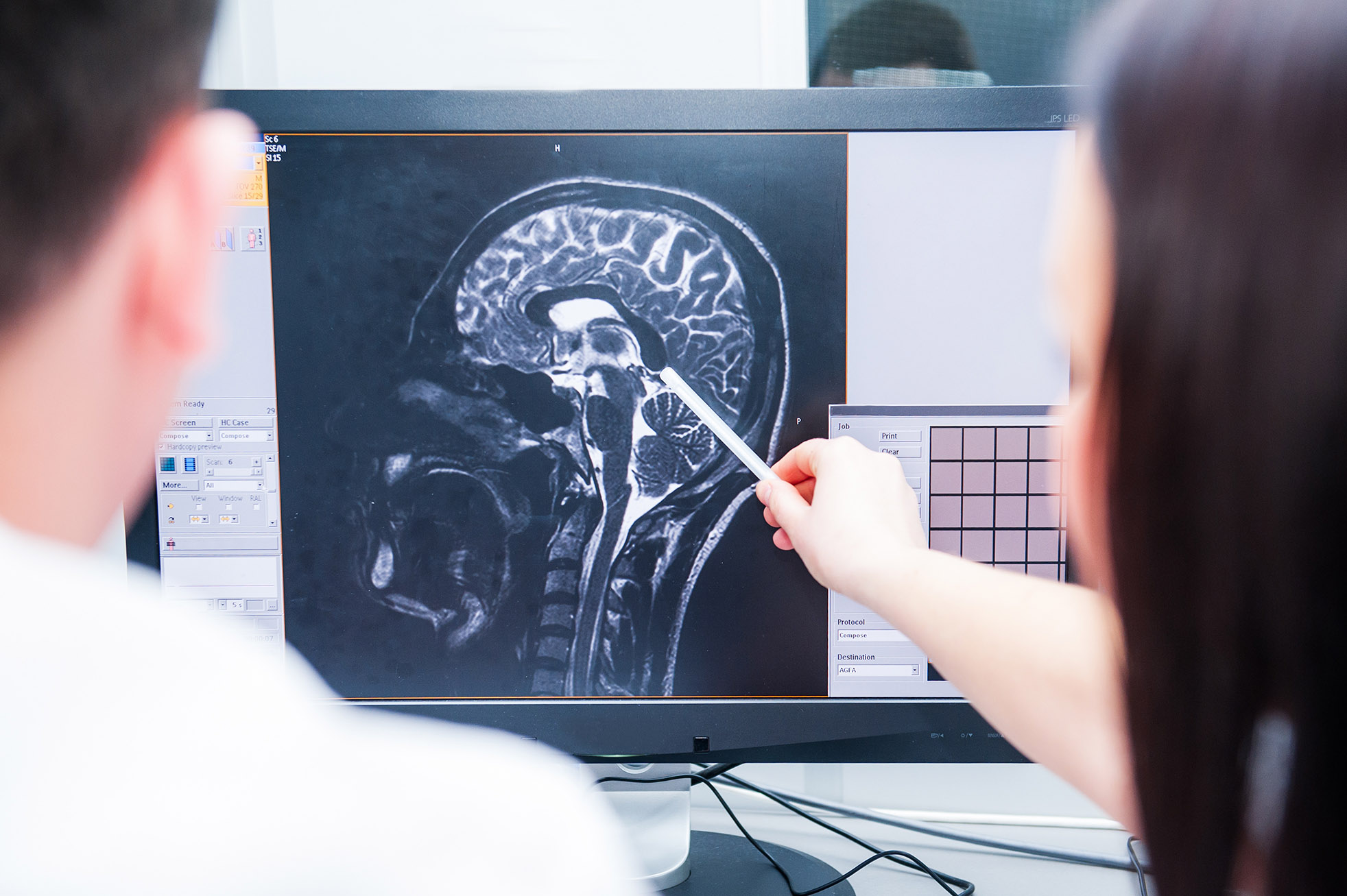 Doctors magnetic resonance image (MRI) injured brain, head injury solicitors Cardiff
